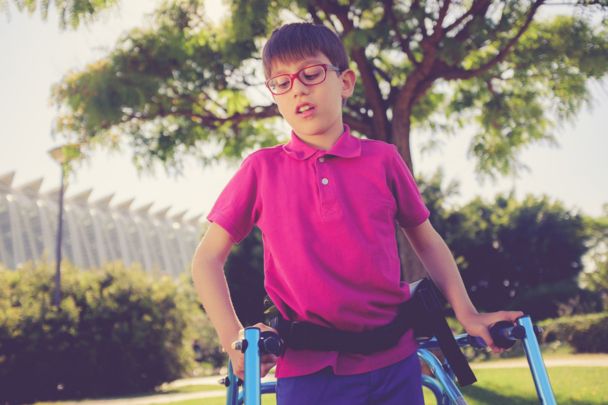 Spinal Balance in Children with Cerebral Palsy and the Benefits of Surgery