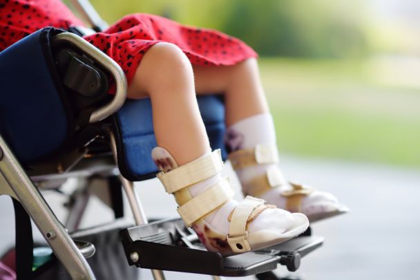 foot-braces-for-children-with-cerebral-palsy