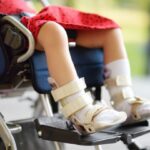 Types of Cerebral Palsy Surgery for Mobility