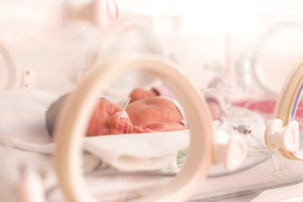 Research Update Increased Prevalence of Cerebral Palsy in Extremely Preterm Infants